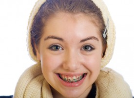 Combien de temps dure un traitement d’orthodontie ?