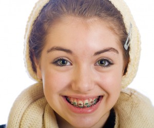 Combien de temps dure un traitement d’orthodontie ?