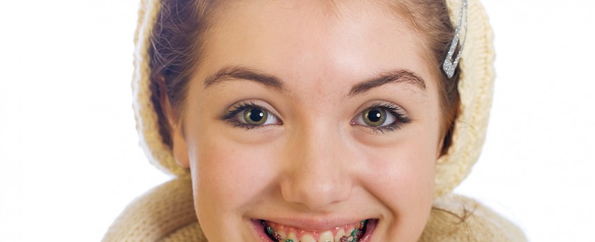 Combien de temps dure un traitement d’orthodontie ?