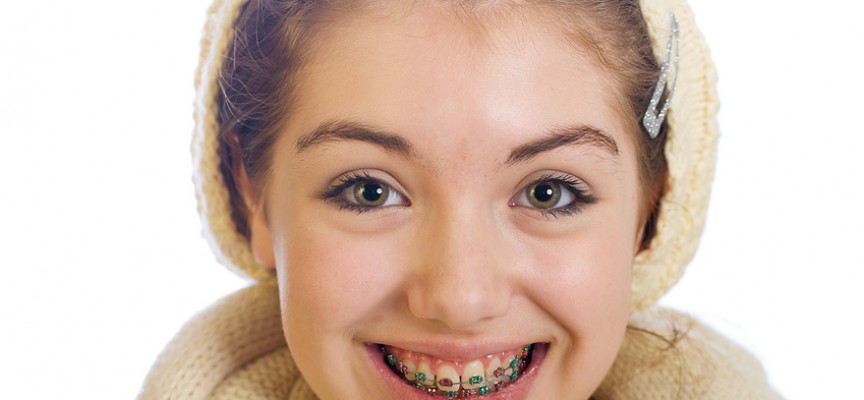 Combien de temps dure un traitement d’orthodontie ?