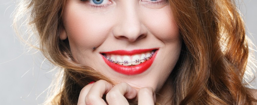 Orthodontie de l’adulte