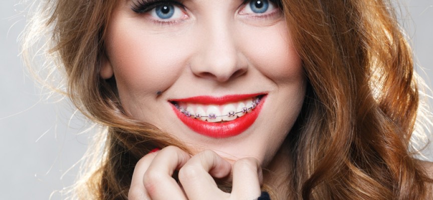 Orthodontie de l’adulte