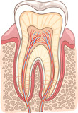 implant dentaire