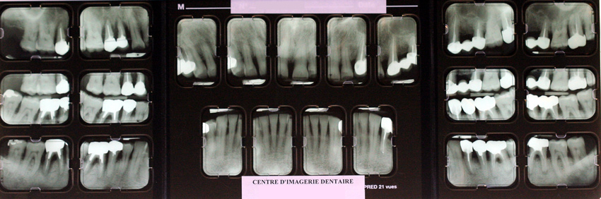 le-BILAN-LONG-CÔNE