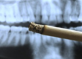 Pourquoi est-il impératif d’arrêter le tabac avant d’entreprendre un traitement parodontal ?