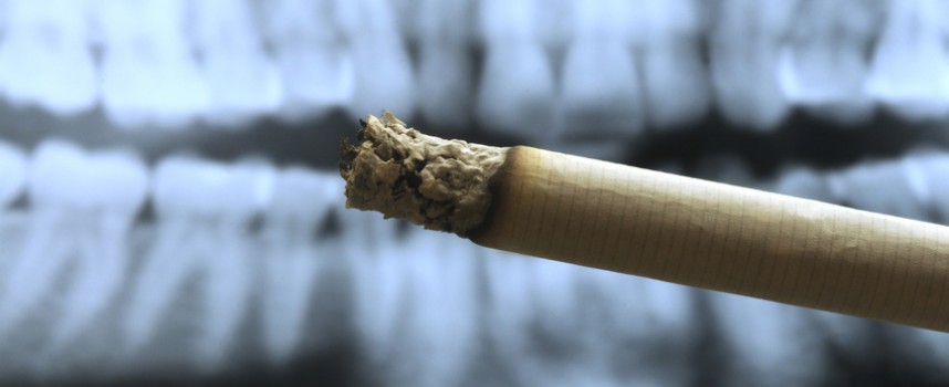 Pourquoi est-il impératif d’arrêter le tabac avant d’entreprendre un traitement parodontal ?