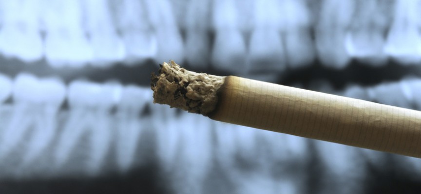 Pourquoi est-il impératif d’arrêter le tabac avant d’entreprendre un traitement parodontal ?