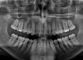 Orthodontie, quelle approche choisir ?