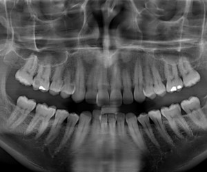 Orthodontie, quelle approche choisir ?
