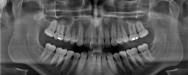 Orthodontie, quelle approche choisir ?