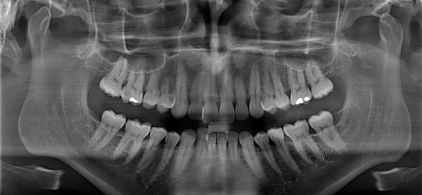 Orthodontie, quelle approche choisir ?